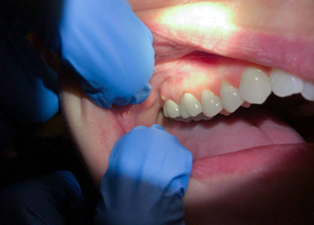 Best Walk-In Emergency Dentist in Belville, NC